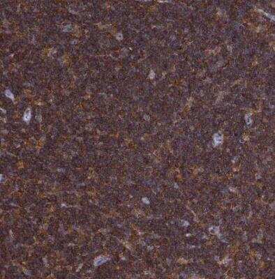 Immunohistochemistry-Paraffin: DOCK10 Antibody [NBP2-58637]