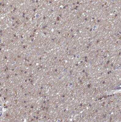 Immunohistochemistry-Paraffin: DOCK10 Antibody [NBP2-58637]