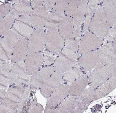 Immunohistochemistry-Paraffin: DOCK10 Antibody [NBP2-58637]