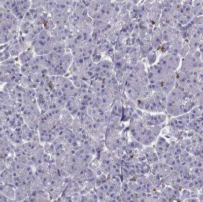 Immunohistochemistry-Paraffin: DOCK10 Antibody [NBP2-58637]