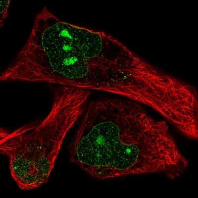 Immunocytochemistry/ Immunofluorescence: DOCK11 Antibody [NBP2-32488]