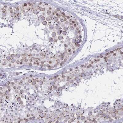 Immunohistochemistry-Paraffin: DOCK11 Antibody [NBP2-32488]