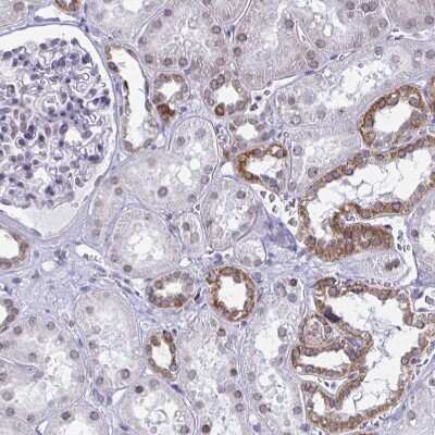Immunohistochemistry-Paraffin: DOCK11 Antibody [NBP2-32488]
