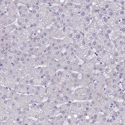 Immunohistochemistry-Paraffin: DOCK11 Antibody [NBP2-32488]