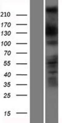 Western Blot: DOCK11 Overexpression Lysate [NBP2-05542]