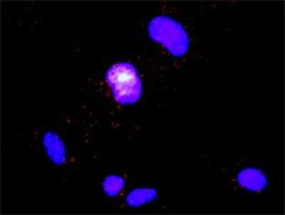 Proximity Ligation Assay: DOCK2 Antibody (2F4) [H00001794-M01]