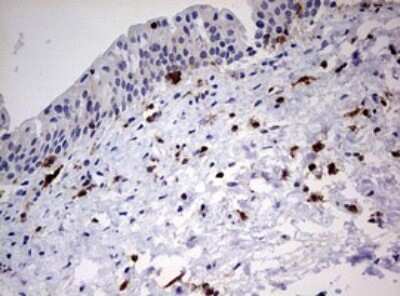 Immunohistochemistry: DOCK2 Antibody (OTI7G2) [NBP2-46468]