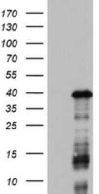 Western Blot: DOCK2 Antibody (OTI7G2) [NBP2-46468]