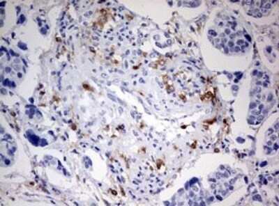 Immunohistochemistry: DOCK2 Antibody (OTI7G2) - Azide and BSA Free [NBP2-70583]