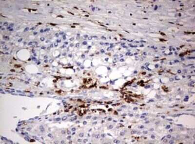 Immunohistochemistry: DOCK2 Antibody (OTI7G2) - Azide and BSA Free [NBP2-70583]