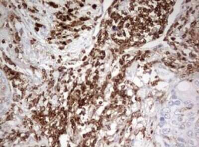 Immunohistochemistry: DOCK2 Antibody (OTI7G2) - Azide and BSA Free [NBP2-70583]