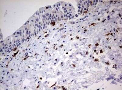 Immunohistochemistry: DOCK2 Antibody (OTI7G2) - Azide and BSA Free [NBP2-70583]