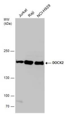 Western Blot: DOCK2 Antibody [NBP3-12944]