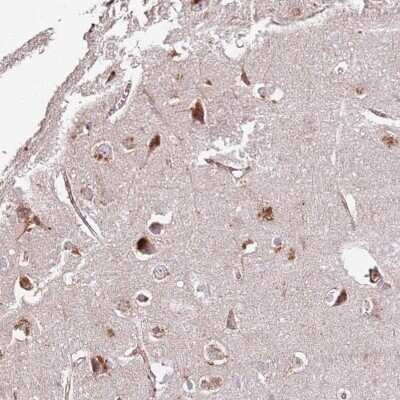 Immunohistochemistry-Paraffin: DOCK6 Antibody [NBP2-33566]