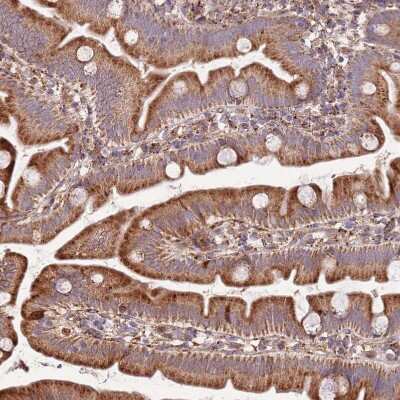 Immunohistochemistry-Paraffin: DOCK6 Antibody [NBP2-33566]