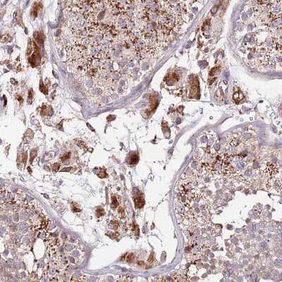 Immunohistochemistry-Paraffin: DOCK6 Antibody [NBP2-33566]