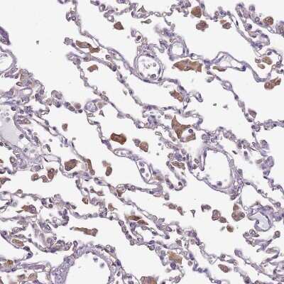 Immunohistochemistry-Paraffin: DOCK9 Antibody [NBP2-38517]