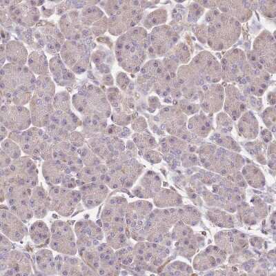 Immunohistochemistry-Paraffin: DOCK9 Antibody [NBP2-38517]