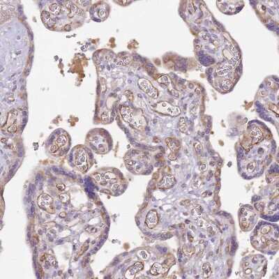 Immunohistochemistry-Paraffin: DOCK9 Antibody [NBP2-38517]