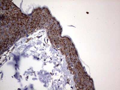 Immunohistochemistry: DOG1/TMEM16A Antibody (OTI1C8) [NBP2-46527]