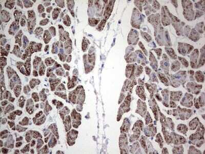 Immunohistochemistry: DOG1/TMEM16A Antibody (OTI1C8) [NBP2-46527]
