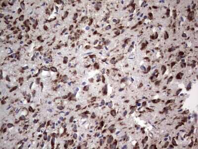 Immunohistochemistry: DOG1/TMEM16A Antibody (OTI1C8) [NBP2-46527]