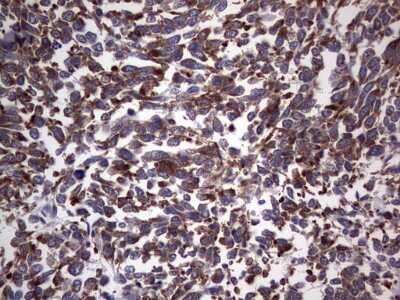 Immunohistochemistry: DOG1/TMEM16A Antibody (OTI1C8) [NBP2-46527]