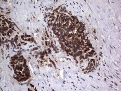 Immunohistochemistry: DOG1/TMEM16A Antibody (OTI1C8) [NBP2-46527]