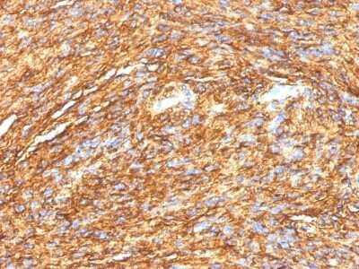 Immunohistochemistry-Paraffin: DOG1/TMEM16A Antibody (DG1/1484) - Azide and BSA Free [NBP2-54492]