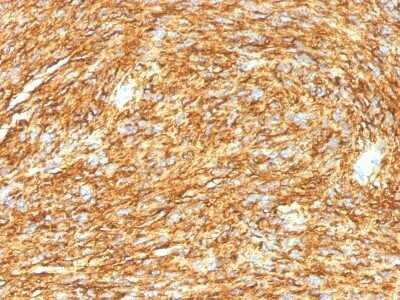 Immunohistochemistry-Paraffin: DOG1/TMEM16A Antibody (DG1/1485) - Azide and BSA Free [NBP2-54485]