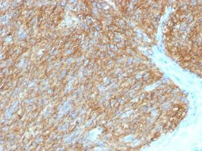 Immunohistochemistry-Paraffin: DOG1/TMEM16A Antibody (DG1/1486) - Azide and BSA Free [NBP2-54484]