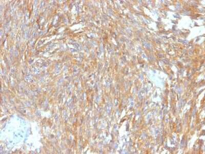 Immunohistochemistry-Paraffin: DOG1/TMEM16A Antibody (DG1/2564R) - Azide and BSA Free [NBP3-08701]