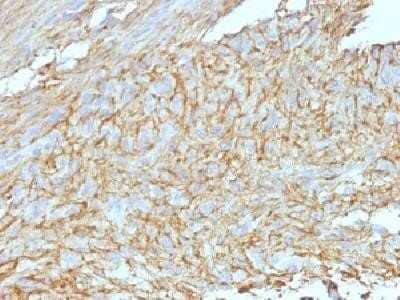 Immunohistochemistry-Paraffin: DOG1/TMEM16A Antibody (DG1/447 + DOG-1.1) - Azide and BSA Free [NBP2-34604]