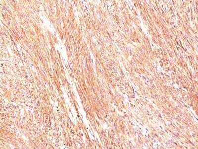 Immunohistochemistry-Paraffin: DOG1/TMEM16A Antibody (DG1/447) - Azide and BSA Free [NBP2-34603]