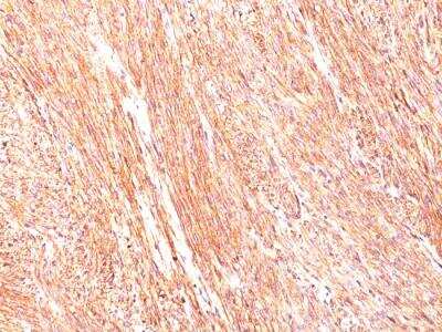 Immunohistochemistry-Paraffin: DOG1/TMEM16A Antibody (DG1/447) - IHC-Prediluted [NBP2-48152]