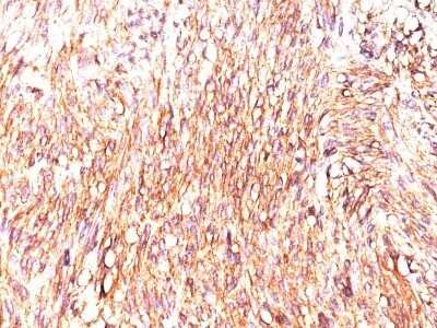 Immunohistochemistry-Paraffin: DOG1/TMEM16A Antibody (DOG-1.1) - Azide and BSA Free [NBP2-34606]