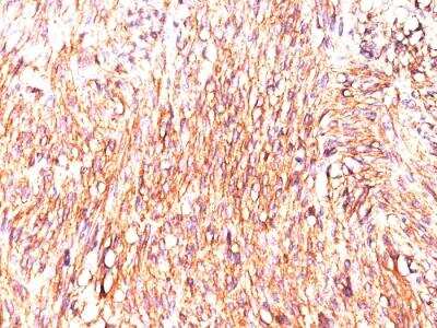 Immunohistochemistry-Paraffin: DOG1/TMEM16A Antibody (DOG-1.1) - IHC-Prediluted [NBP2-48151]