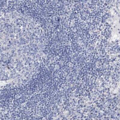 Immunohistochemistry-Paraffin: DOG1/TMEM16A Antibody [NBP2-14296]