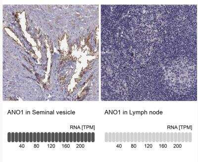 Immunohistochemistry-Paraffin: DOG1/TMEM16A Antibody [NBP2-76552]