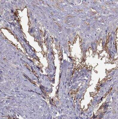 Immunohistochemistry-Paraffin: DOG1/TMEM16A Antibody [NBP2-76552]