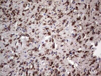 Immunohistochemistry: DOG1/TMEM16A Antibody (OTI1C8) - Azide and BSA Free [NBP2-71987]