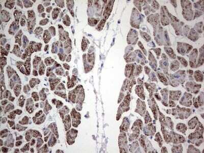 Immunohistochemistry: DOG1/TMEM16A Antibody (OTI1C8) - Azide and BSA Free [NBP2-71987]