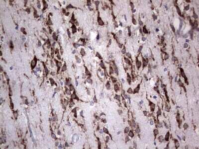 Immunohistochemistry: DOG1/TMEM16A Antibody (OTI1C8) - Azide and BSA Free [NBP2-71987]