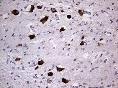 Immunohistochemistry: DOG1/TMEM16A Antibody (OTI1C8) - Azide and BSA Free [NBP2-71987]