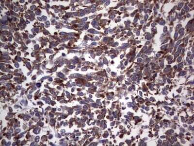 Immunohistochemistry: DOG1/TMEM16A Antibody (OTI1C8) - Azide and BSA Free [NBP2-71987]