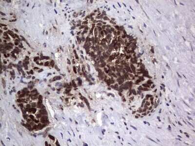 Immunohistochemistry: DOG1/TMEM16A Antibody (OTI1C8) - Azide and BSA Free [NBP2-71987]