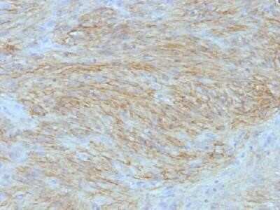Immunohistochemistry-Paraffin: DOG1/TMEM16A Antibody (SPM580) - Azide and BSA Free [NBP2-34812]