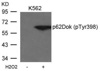 Western Blot: DOK1 [p Tyr398] Antibody [NB100-82113]