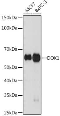 Western Blot: DOK1 Antibody (6U4U9) [NBP3-15713]