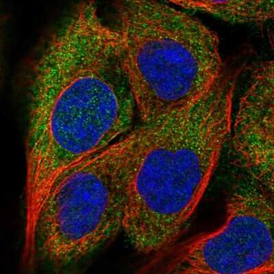 Immunocytochemistry/ Immunofluorescence: DOK1 Antibody [NBP2-55613]